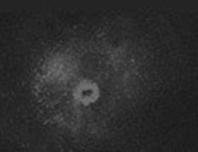 XRF Gun Shot Residue Scatter Analysis