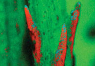 Elemental Analysis of Silicon in Plant Material with Variable-Pressure SEM