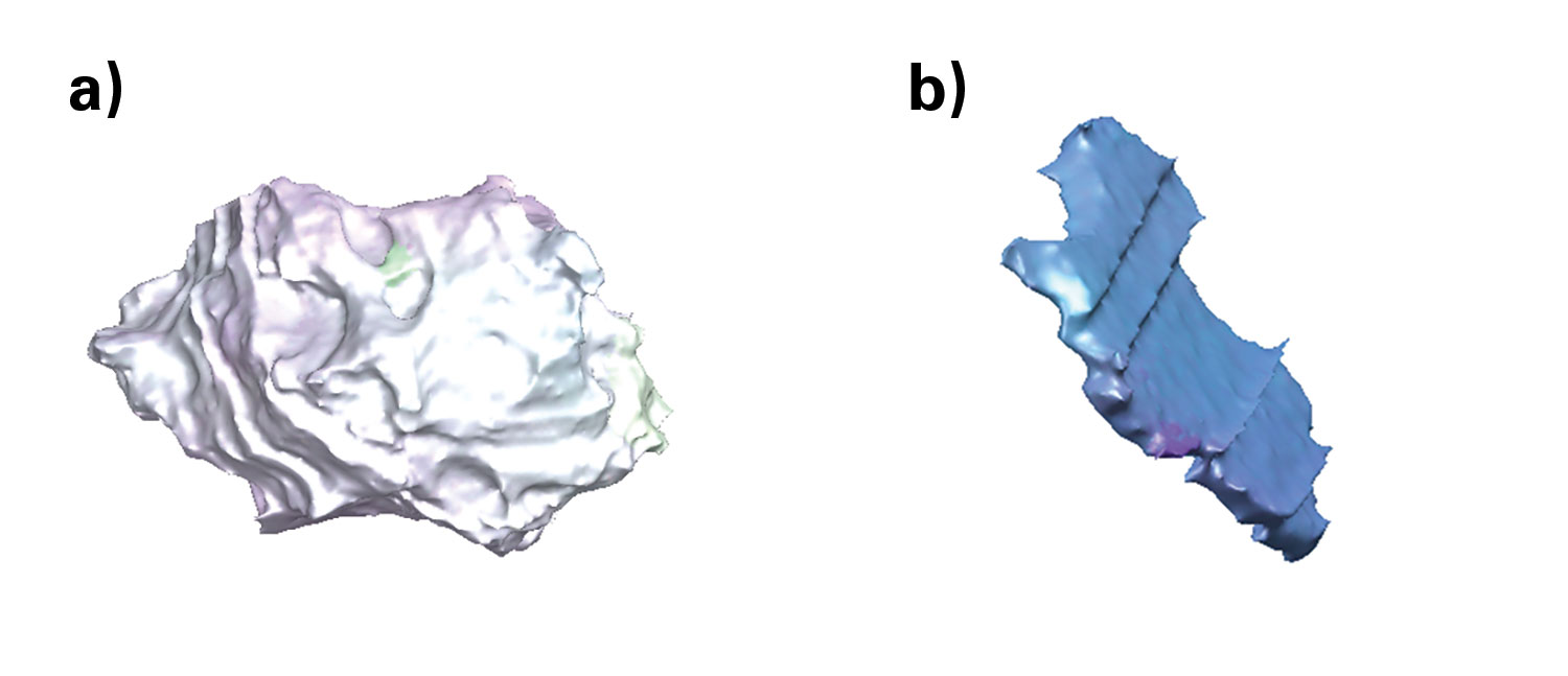 この微細構造から得られた2つの異なる結晶粒 a)は典型的な均質結晶粒、b)はより薄い双晶結晶粒。